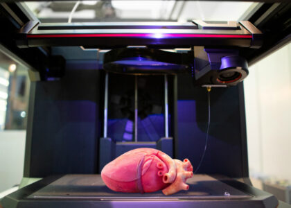 3D Bioprinted Organ Transplants Market