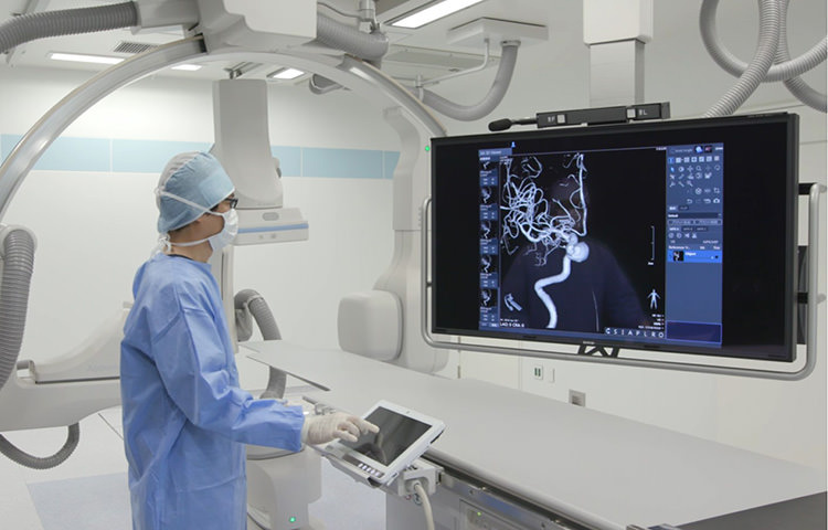 Angiography Devices Market