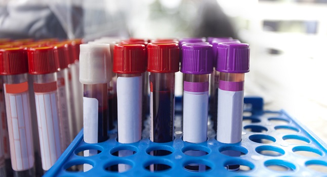 Endocrine Testing Market