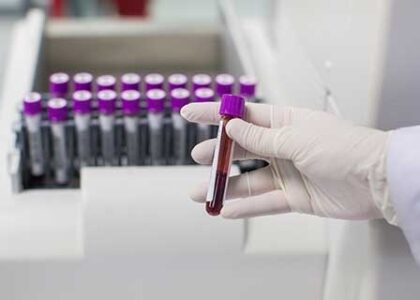 Hematology Diagnostics Market