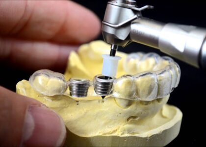 3D Printed Medical Implants Market
