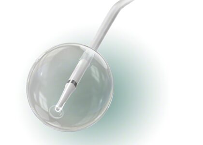 Balloon Catheter Market