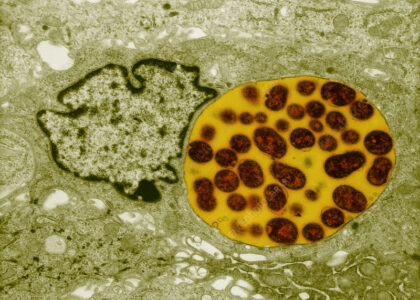 Chlamydia Diagnostics Market