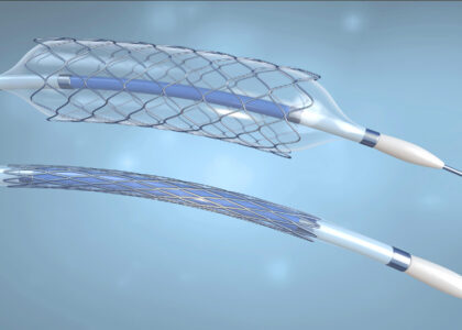 Dual Balloon Angioplasty Catheter Market