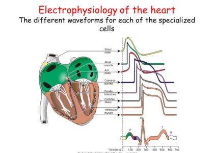 Electrophysiology Market