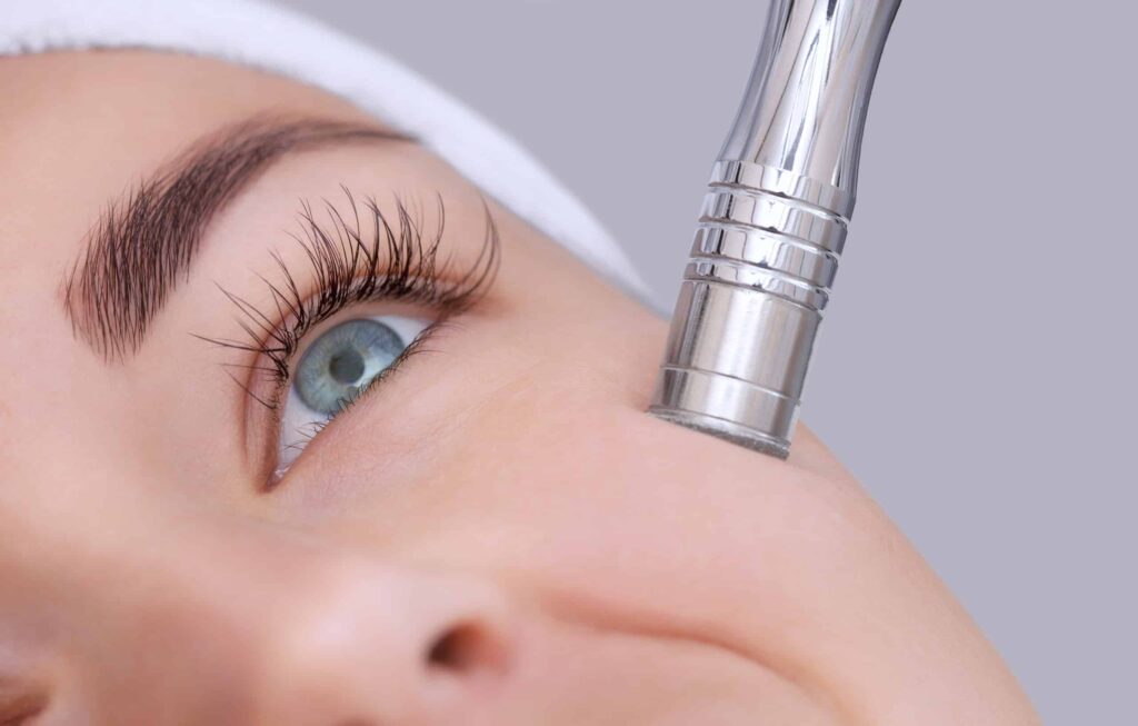 Microdermabrasion Devices Market