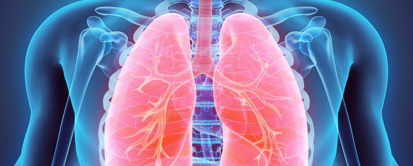 Non-Small Cell Lung Cancer Market