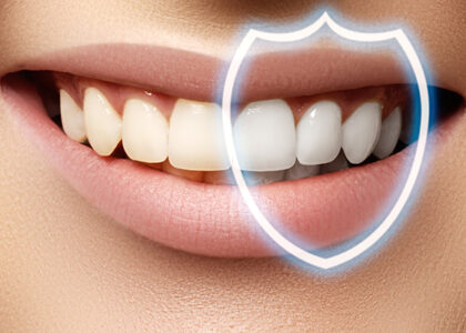 Global Teeth Whitening Market