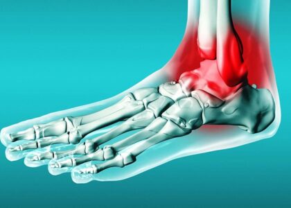 Tendonitis Treatment Market