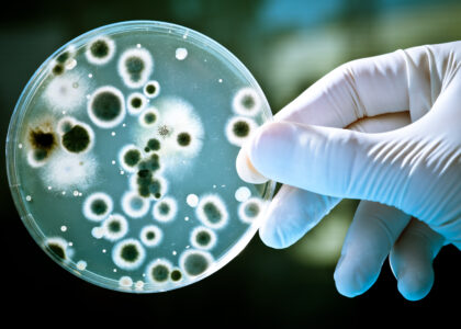 Antimicrobial Nanocoatings Market