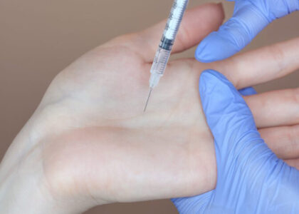 Axillary Hyperhidrosis Treatment Market