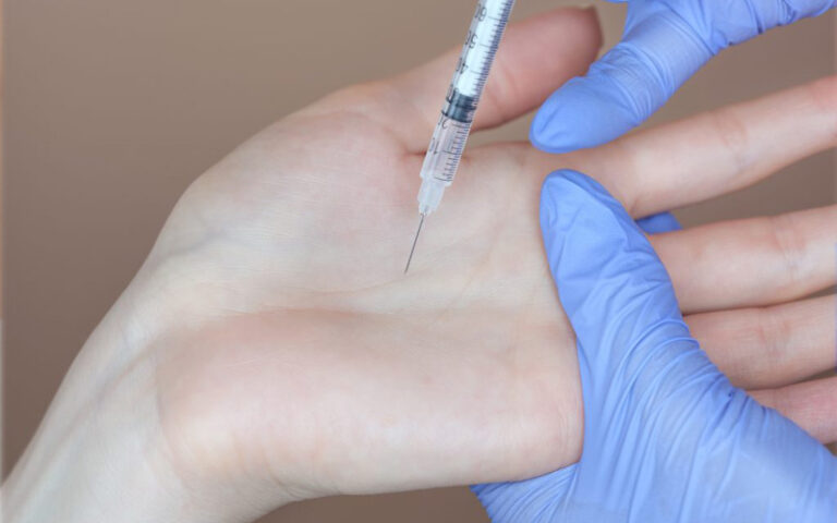 Axillary Hyperhidrosis Treatment Market