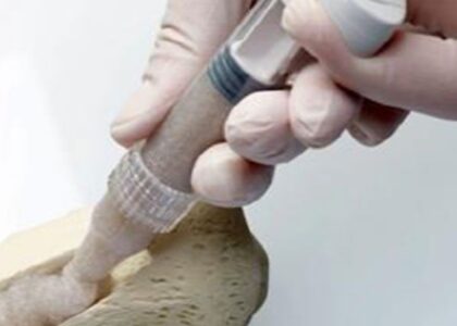 Bone Grafts and Substitutes Market