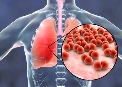 Community Acquired Bacterial Pneumonia (CABP) Treatment Market