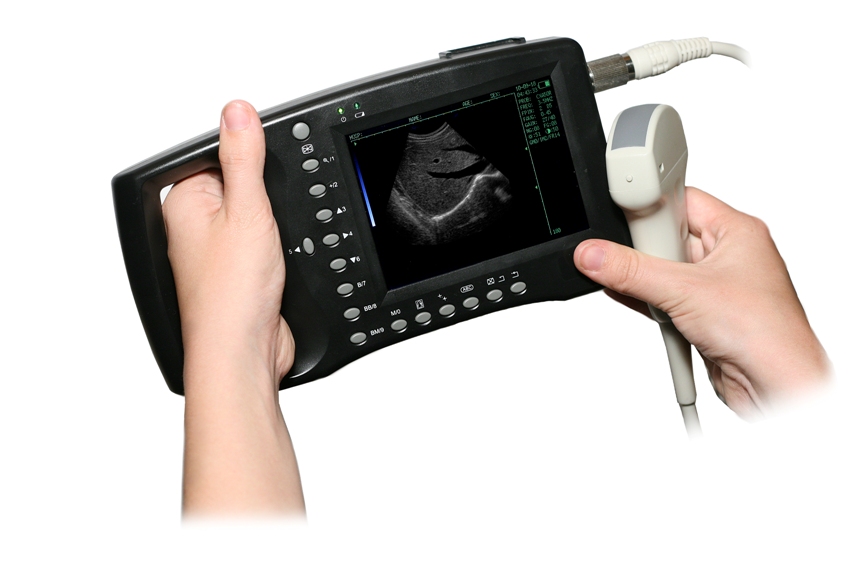 Handheld Ultrasound Scanner Market