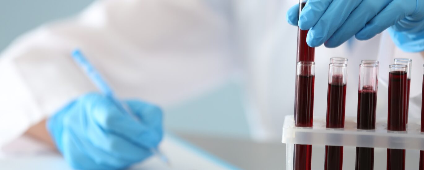 Large Molecule Bioanalytical Testing Services