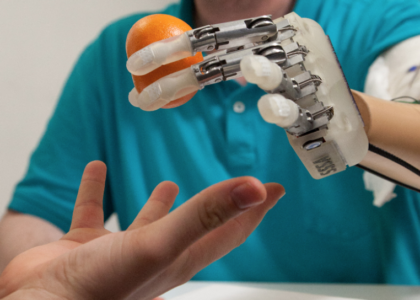 Medical Bionic Implants And Exoskeletons Market