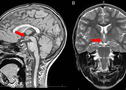 Perfusion Imaging Market
