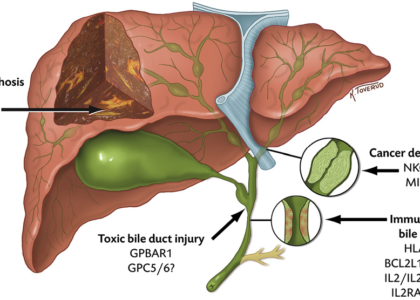 Primary Sclerosing Cholangitis (PSC) Market