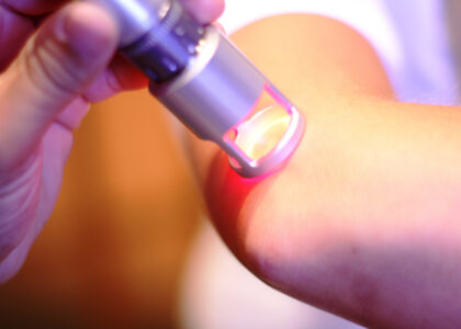 Cold Laser Therapy Market