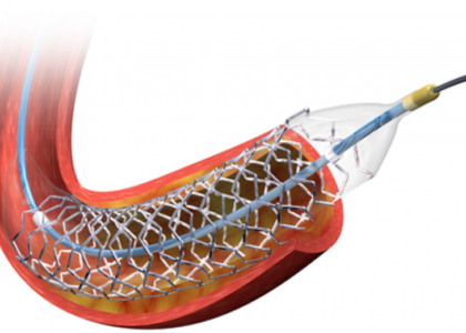 Coronary Stents Market