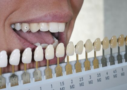 Global Acrylic Teeth Industry