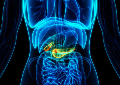 Global Pancreatic Cancer Industry