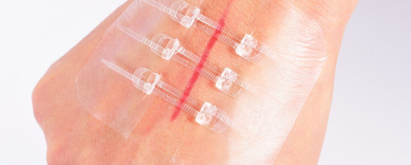 Hemostatic for Wound Closure Market