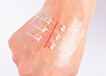 Hemostatic for Wound Closure Market