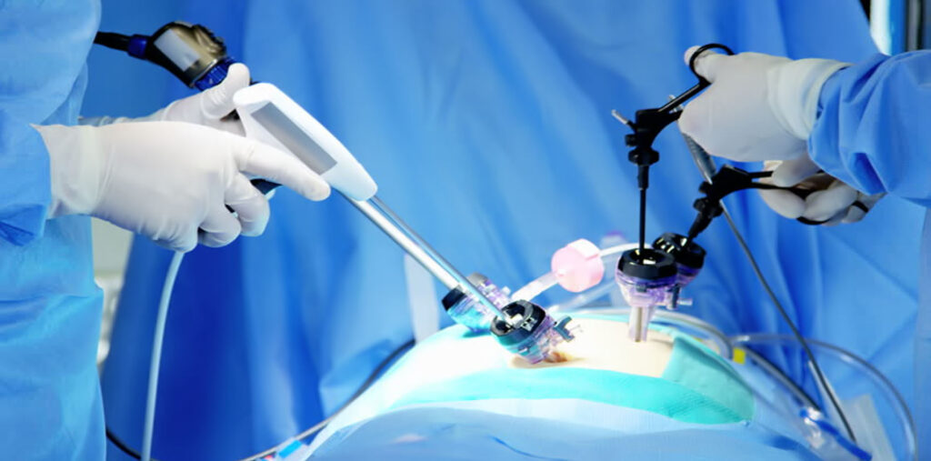 Laparoscopic Device Market