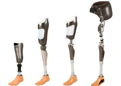 Motorized Prosthesis Industry