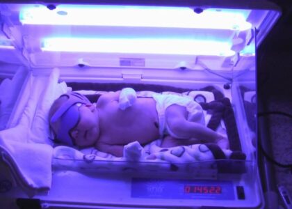 Phototherapy Treatment Industry