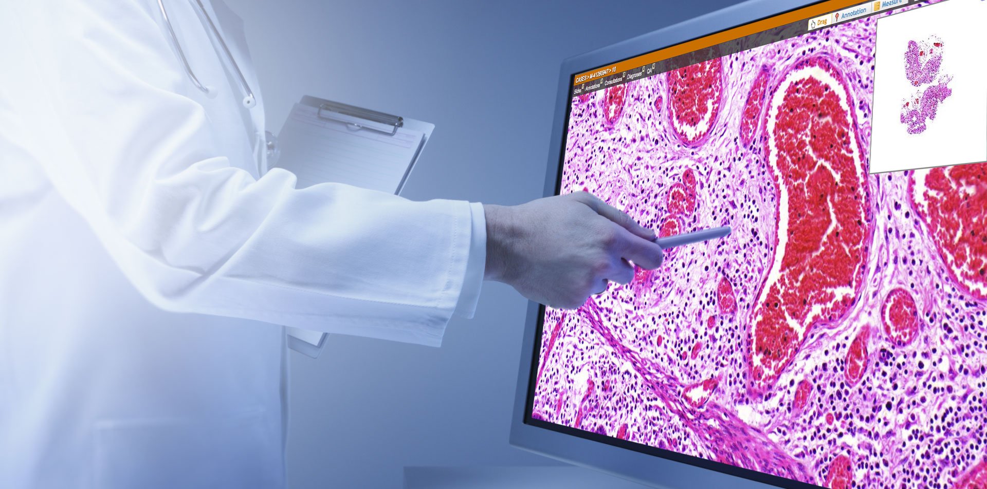 Quantitative Pathology Imaging Market is on an upward trajectory
