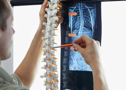 Spinal Imaging Market