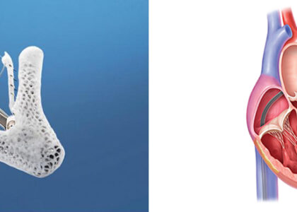 Global Transcatheter Heart Valve Replacement Market