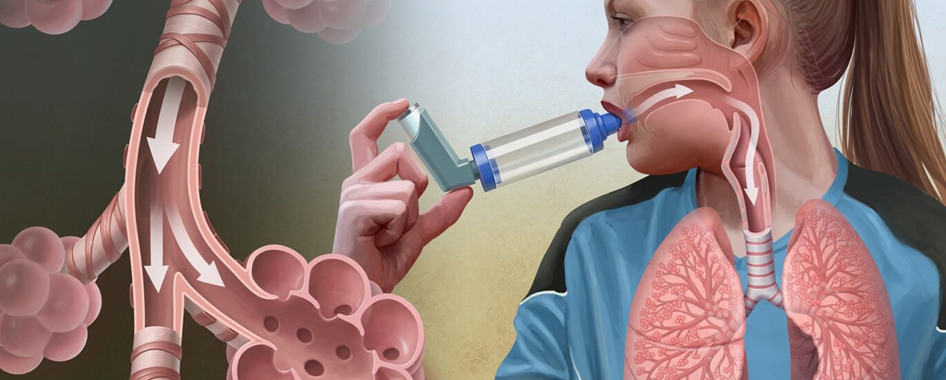 Global Airway Disease Treatment Market