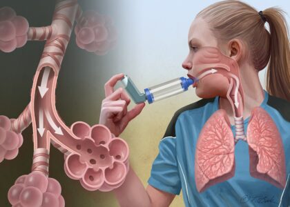 Global Airway Disease Treatment Market