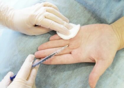 Axillary Hyperhidrosis Treatment Market