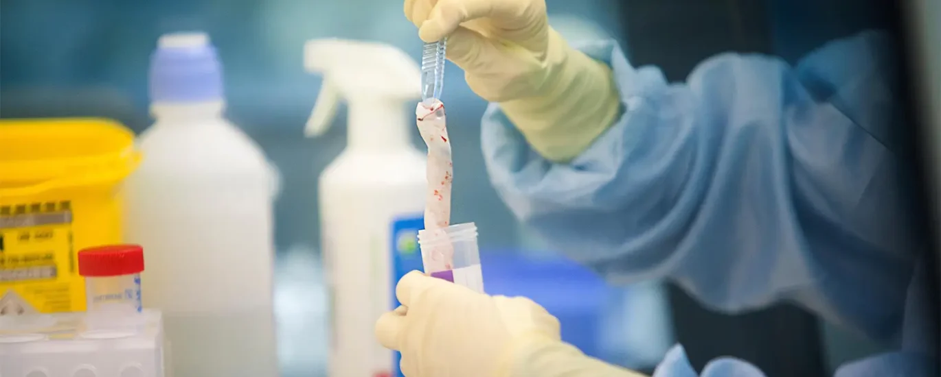 Global Birth Tissue Products Market