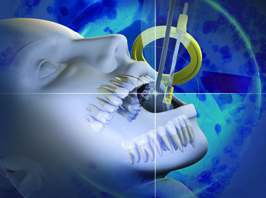 Dental X-ray Systems Market