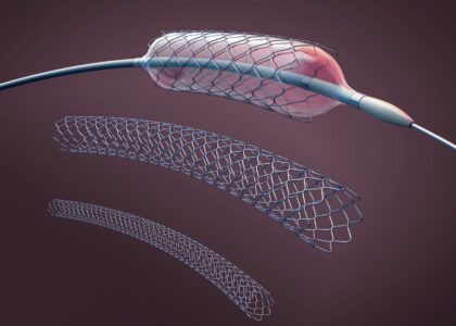 Global Micro Balloon Catheter Industry