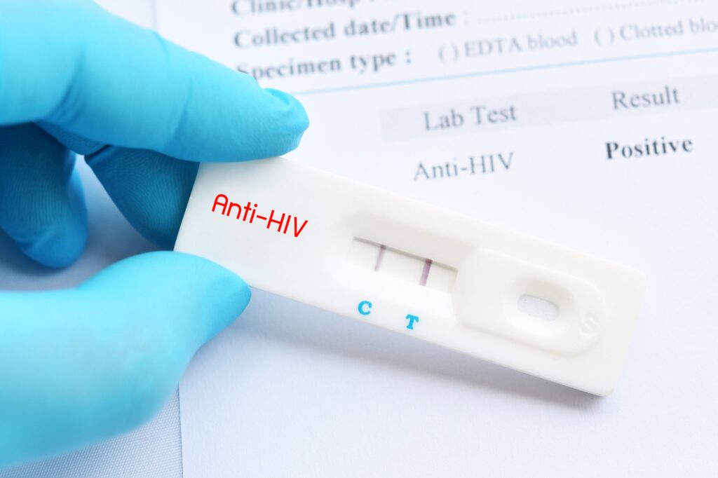 HIV Antivirals Market