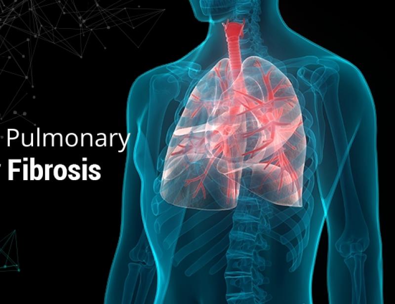 Idiopathic Pulmonary Fibrosis Management Market