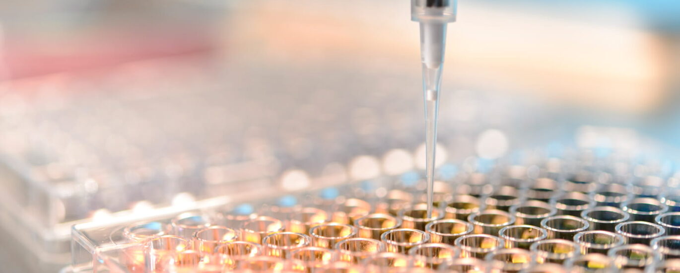 PD-L1 Biomarker Testing Market