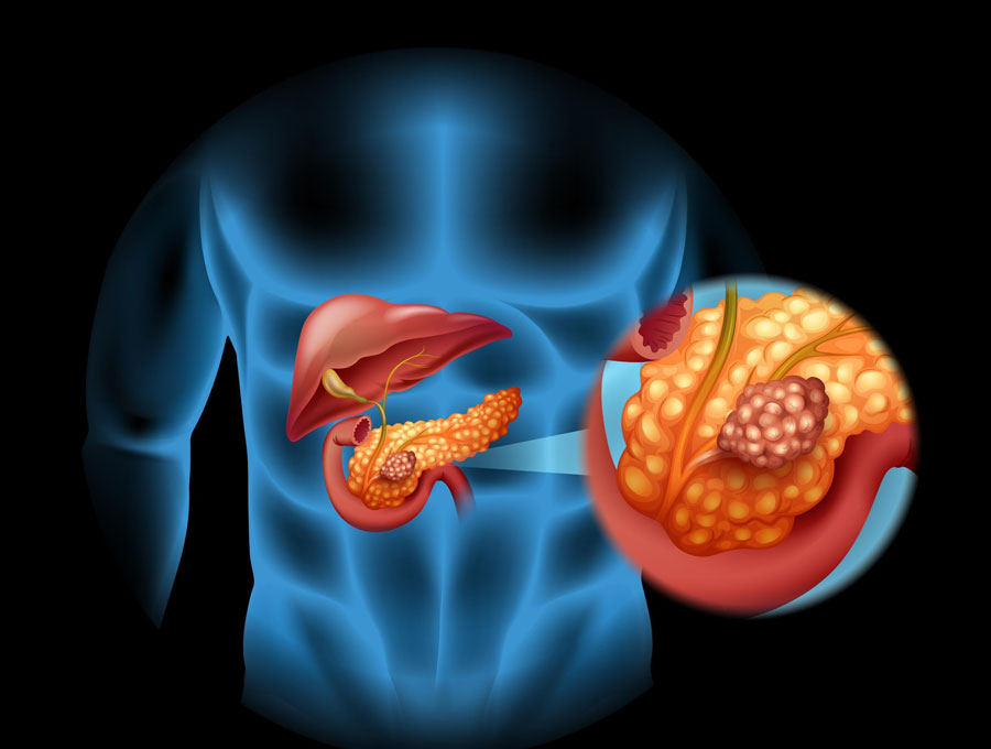 Pancreatic Elastase Testing Market