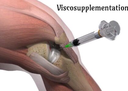 Russia Viscosupplementation Market