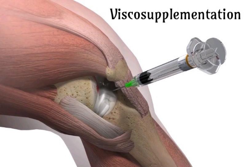 Russia Viscosupplementation Market
