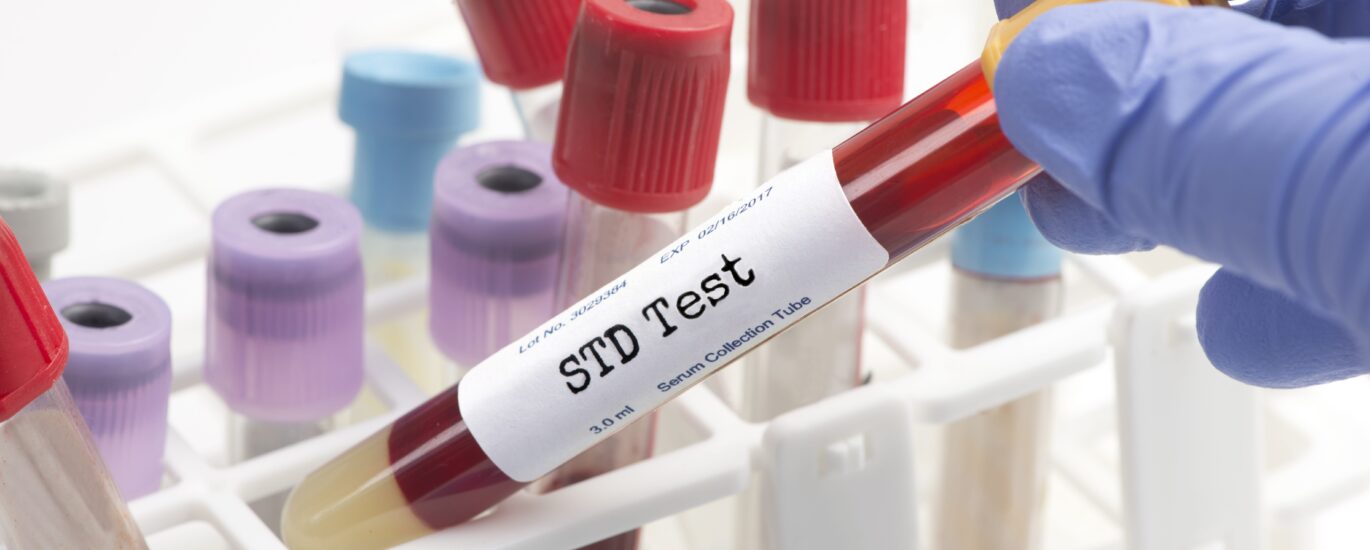 Sexually Transmitted Diseases Diagnostics Market