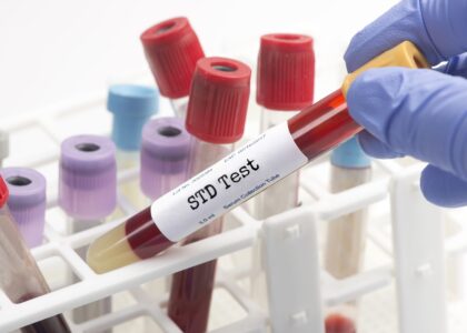 Sexually Transmitted Diseases Diagnostics Market