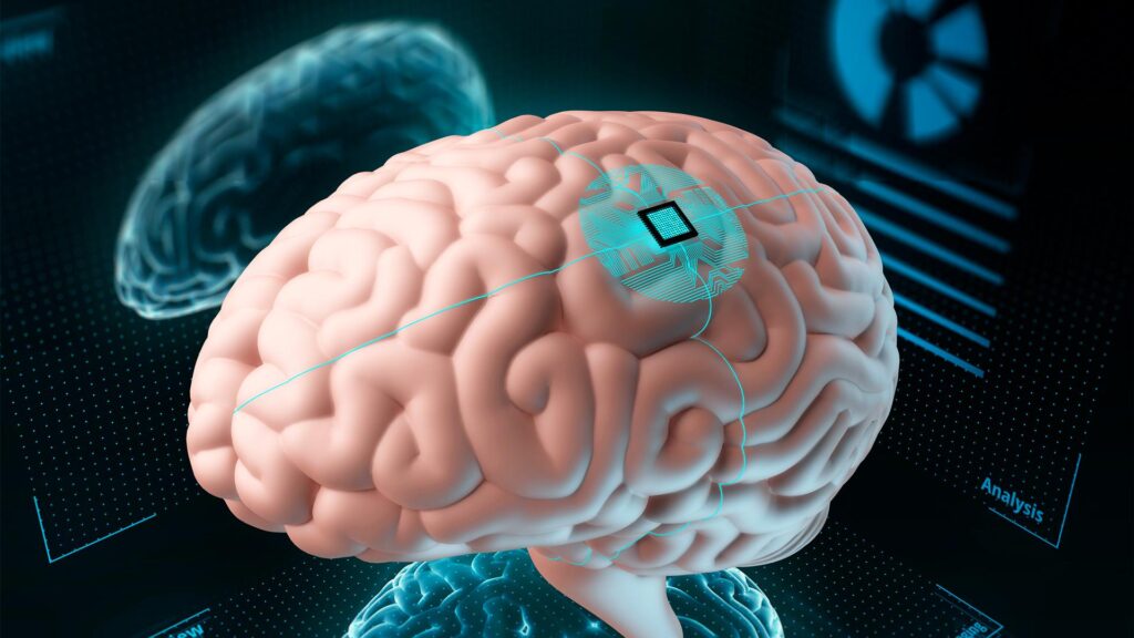 3D Printed Brain Models Industry